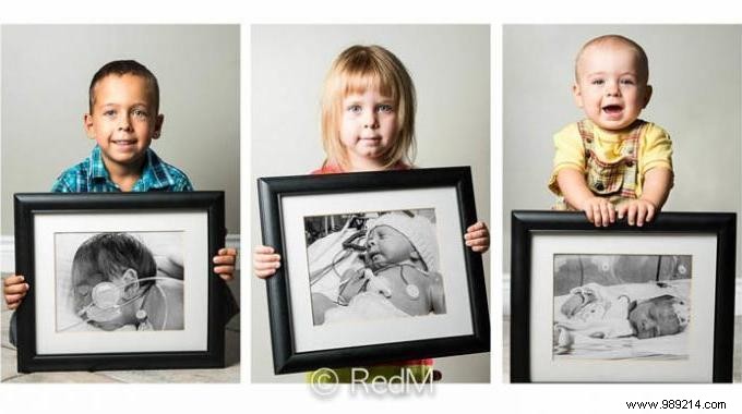 17 Photos of Premature Babies Who Hold Photo Two When They Were Babies. 