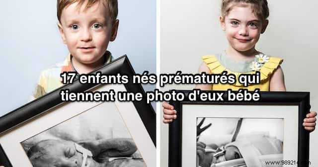 17 Photos of Premature Babies Who Hold Photo Two When They Were Babies. 