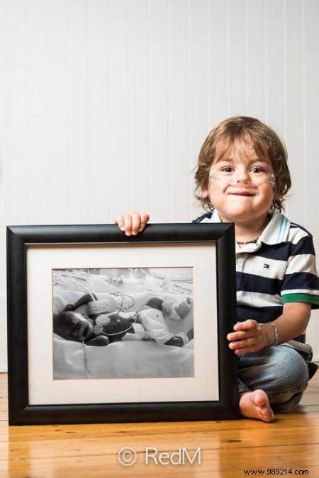 17 Photos of Premature Babies Who Hold Photo Two When They Were Babies. 