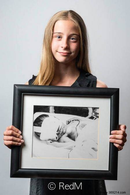 17 Photos of Premature Babies Who Hold Photo Two When They Were Babies. 