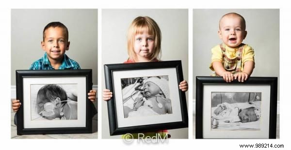 17 Photos of Premature Babies Who Hold Photo Two When They Were Babies. 