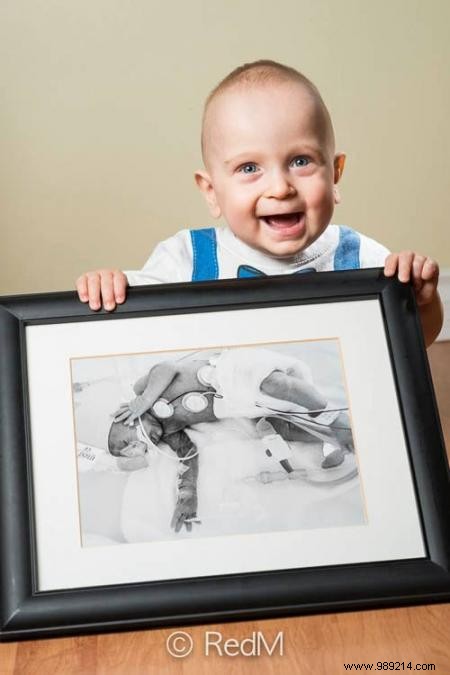 17 Photos of Premature Babies Who Hold Photo Two When They Were Babies. 