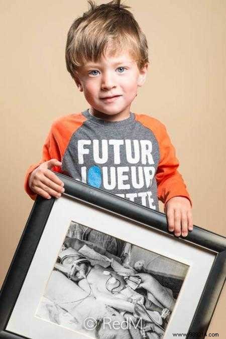 17 Photos of Premature Babies Who Hold Photo Two When They Were Babies. 