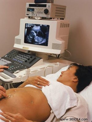 Price for EmbryoScope 