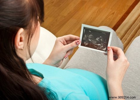 Embryo with DNA from three people 