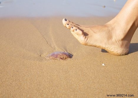 5 frequently asked questions about jellyfish bites 