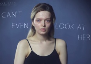 Must-See:Acne &Makeup Video 