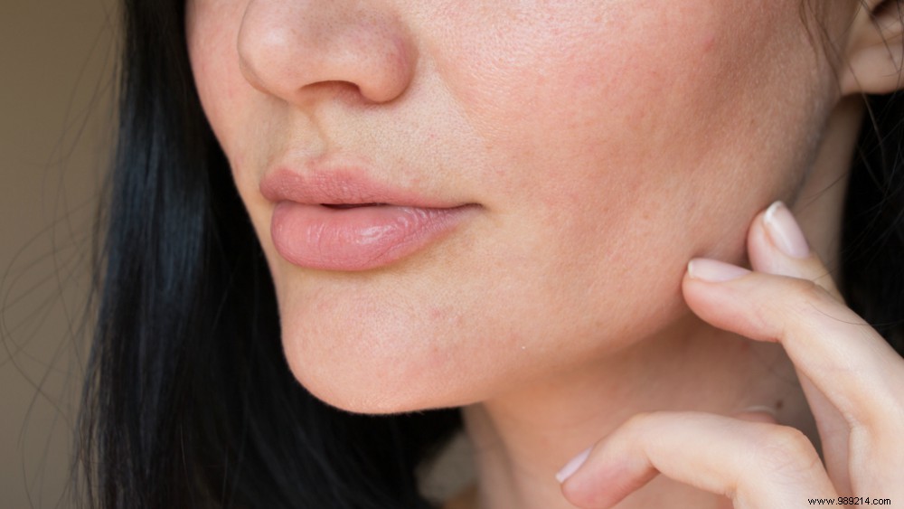 7 unexpected causes of dry skin 