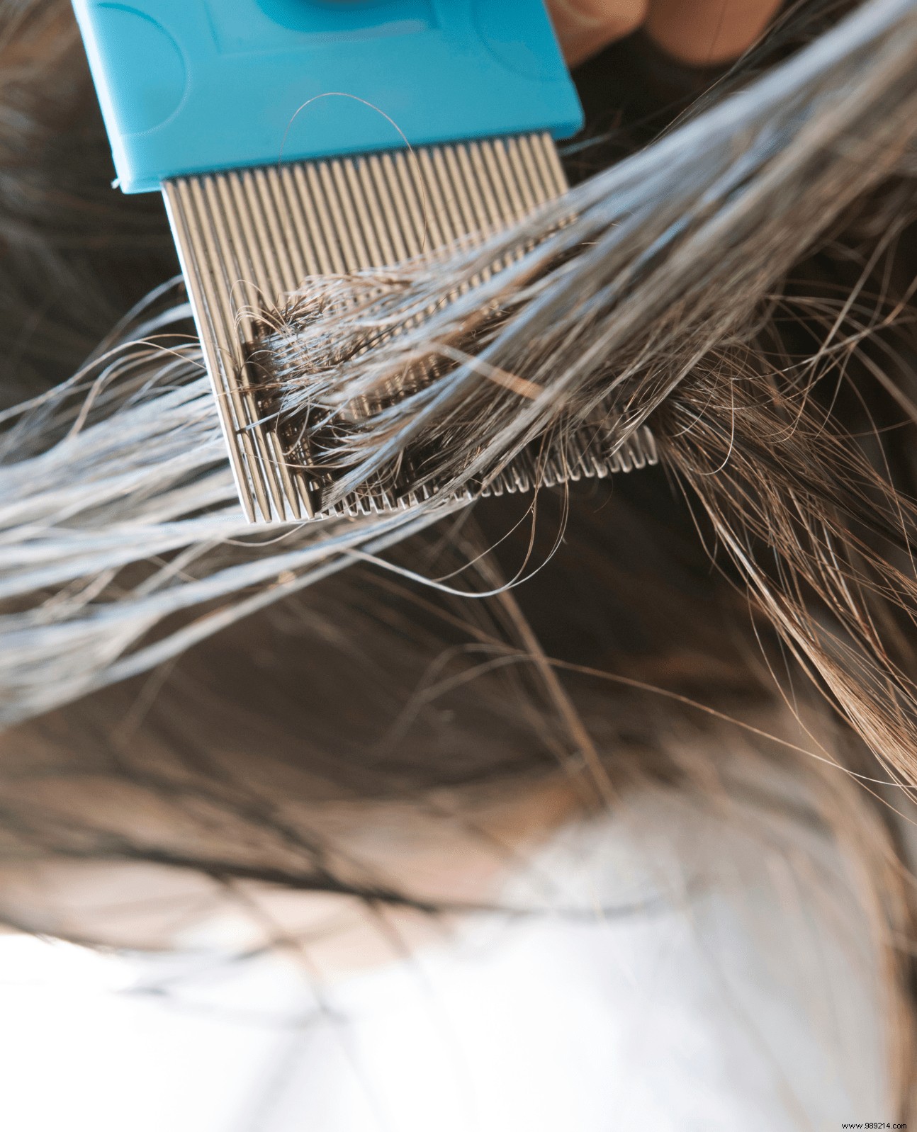 How to treat head lice naturally:our tips 