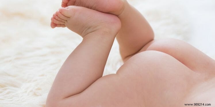 Diaper rash, how to treat it? 