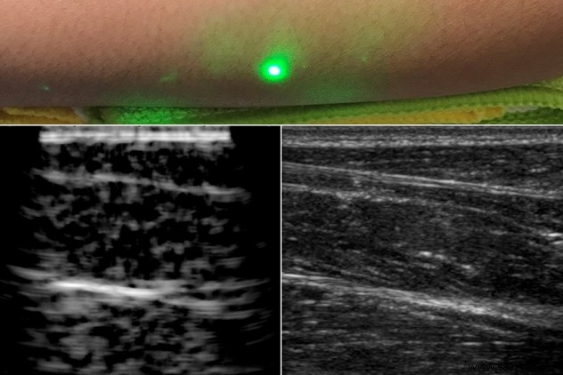 They obtain the first laser ultrasound images of human beings! 