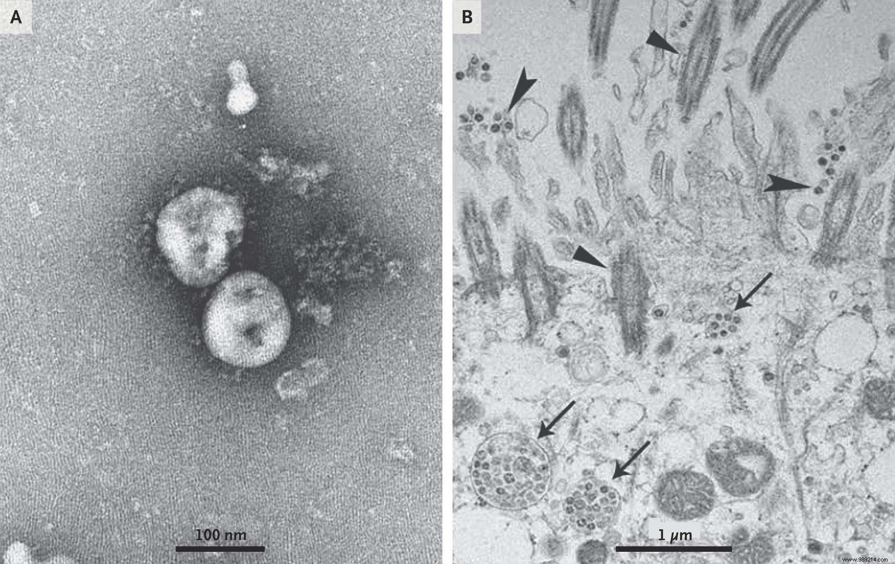 What is the typical profile of Wuhan coronavirus victims? 