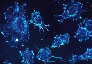 Cancer:an unprecedented genetic breakthrough! 