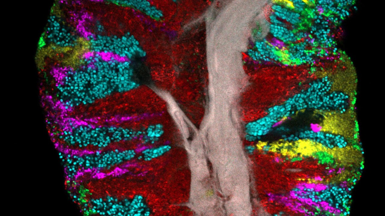 How bacteria form communities on our tongue 