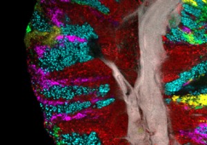 How bacteria form communities on our tongue 