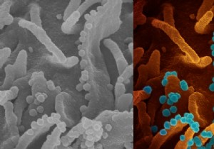 SARS-CoV-2:This is what a  viral shedding  looks like under a microscope 