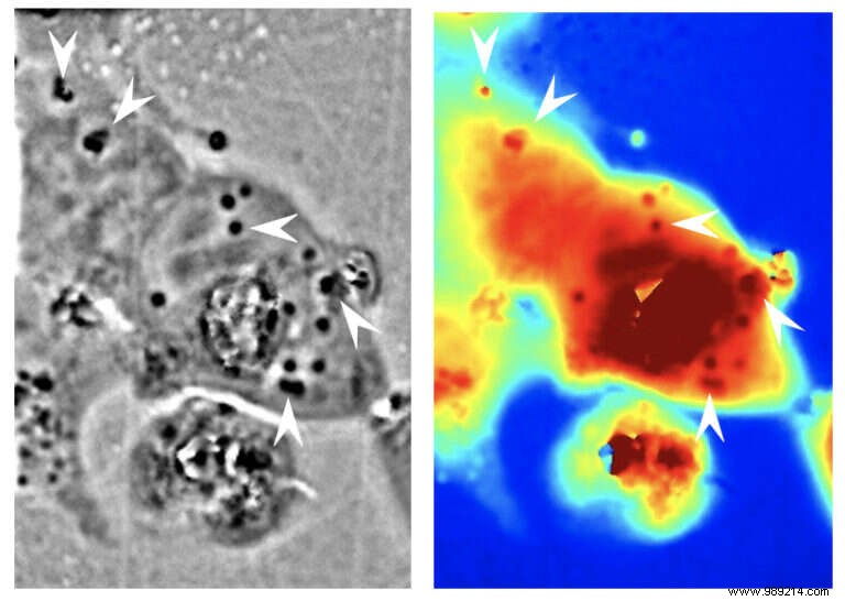 Camouflage:they managed to make human cells  transparent  