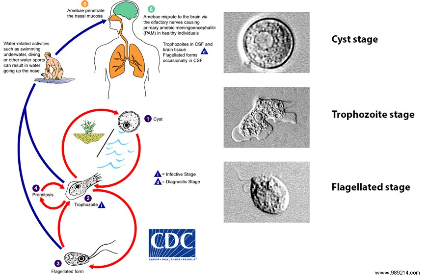 A brain-eating amoeba contaminates drinking water in Texas! 