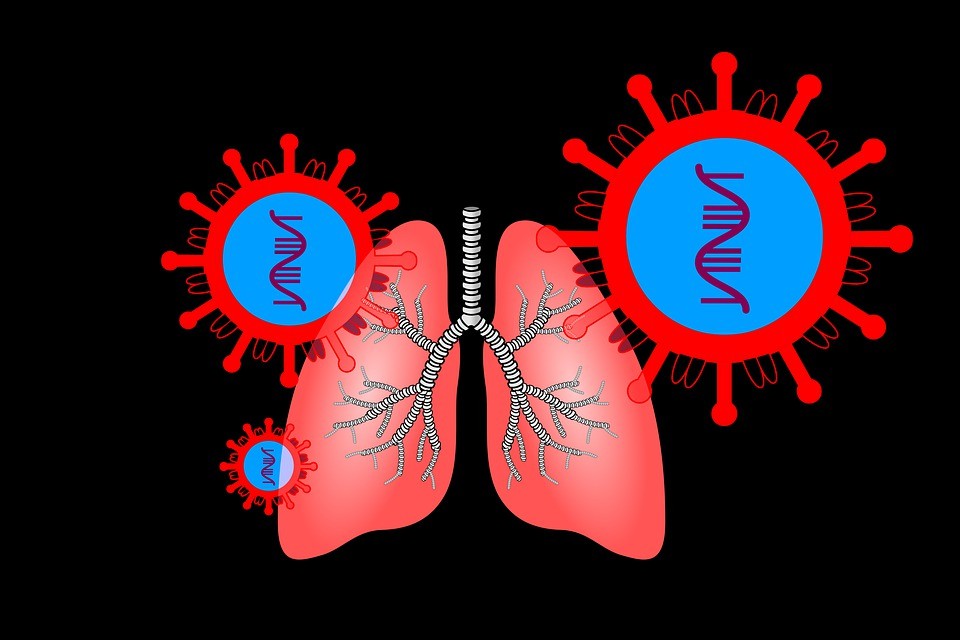 Covid-19: abnormal cells  causing lung damage 