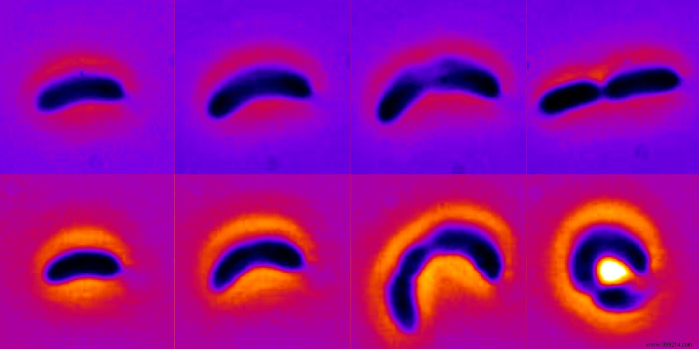 Bacteria that change shape to avoid antibiotics 