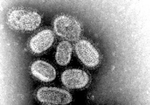 Two strains of flu virus may have disappeared 