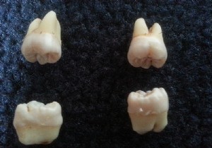 This Study Explains Why Wisdom Teeth Only Grow in Adulthood 