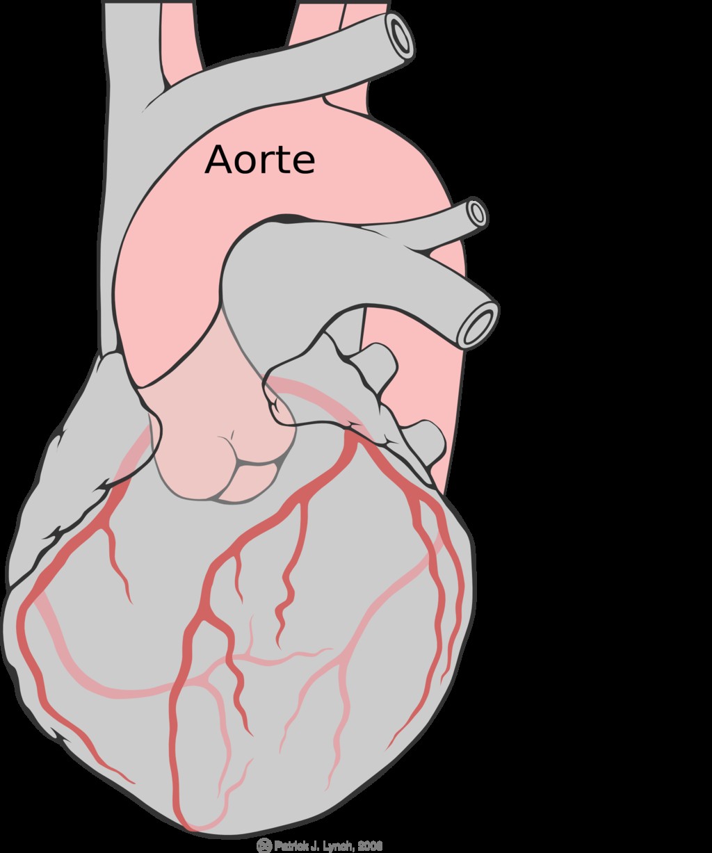 What are the differences between  cardiac arrest  and  heart attack ? 