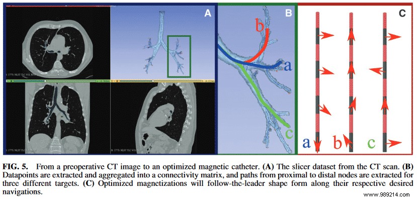 Cancer:this soft robot capable of navigating the lungs is a real breakthrough 